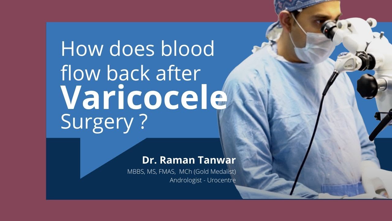 How does blood flow after Varicocele Surgery? Surgery ke baad testis se khoon wapas kaise jata hai?