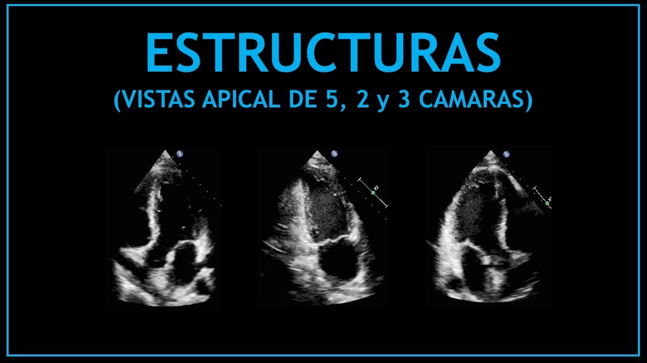 ESTRUCTURAS cardiacas! (Vista apical 5, 2 y 3 camaras - Ecocardiografia)