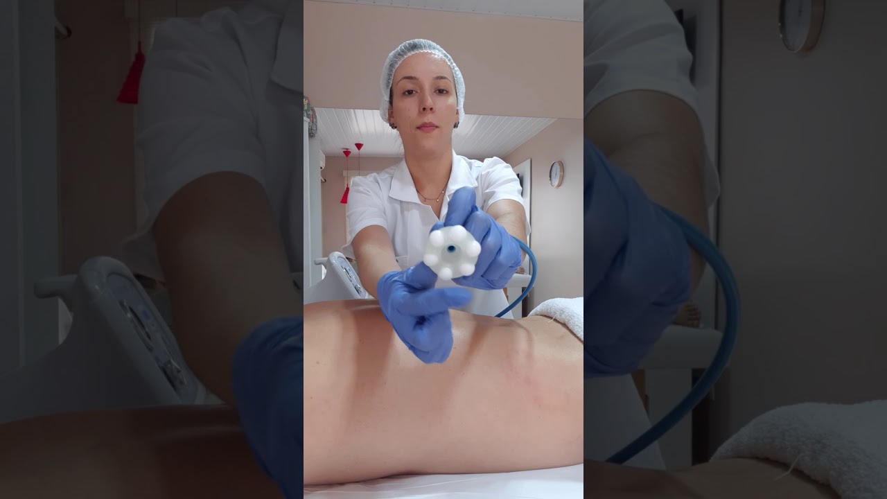 Endermologia e vacuoterapia - Amanda Sabino
