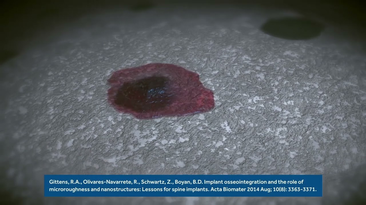 Animation: nanoLOCK&trade; Surface Technology