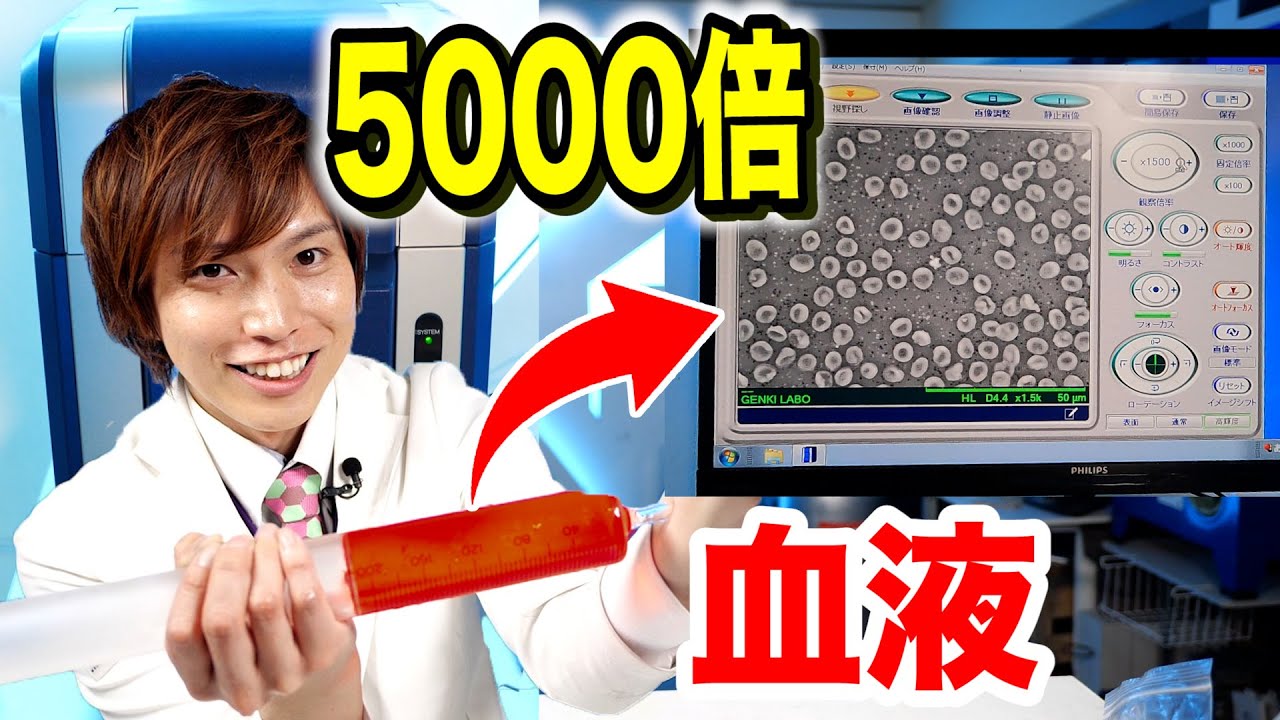 【はたらく細胞】自分の血液を５０００倍に拡大したら凄いもの見えた！【電子顕微鏡】Possibility science challenge