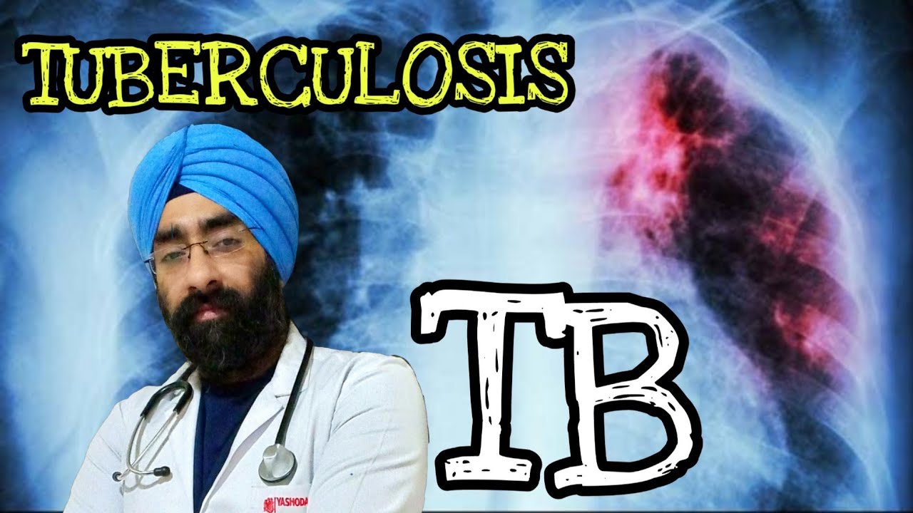 Tuberculosis - The Medical BASICS of TB explained | Dr.Education (Eng)