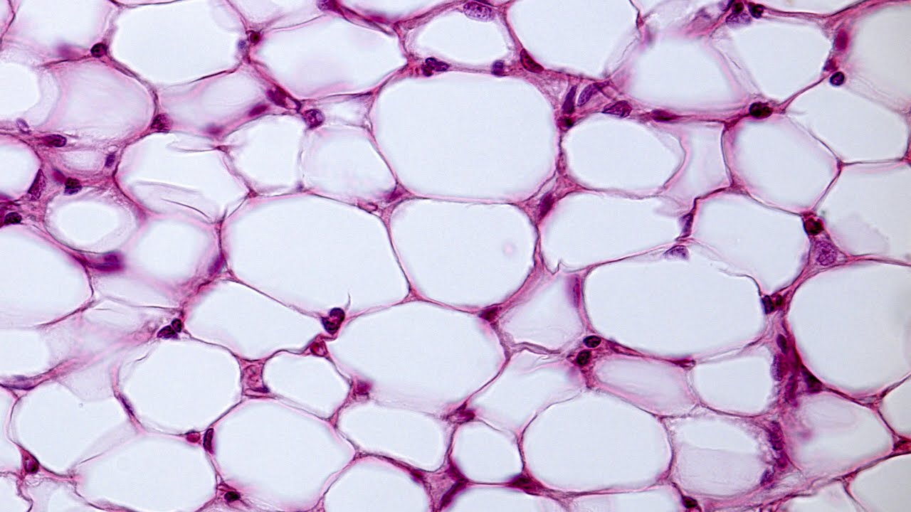 Adipose Tissue-Derived Stem Cells (ADSCs)