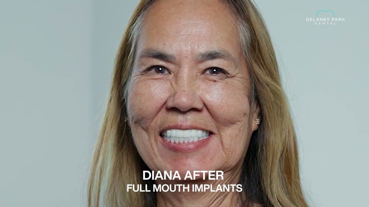Delaney Park Dental - Diana's Story