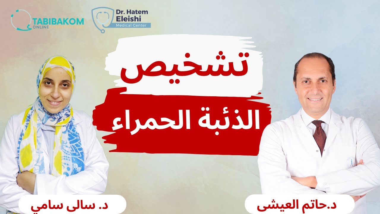 تشخيص الذئبة الحمراء مع د سالي