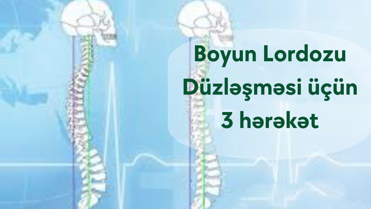 Boyun Lordozu Düzləşməsi 3 hərəkət | Fizioterapevt Aziz Davrishov
