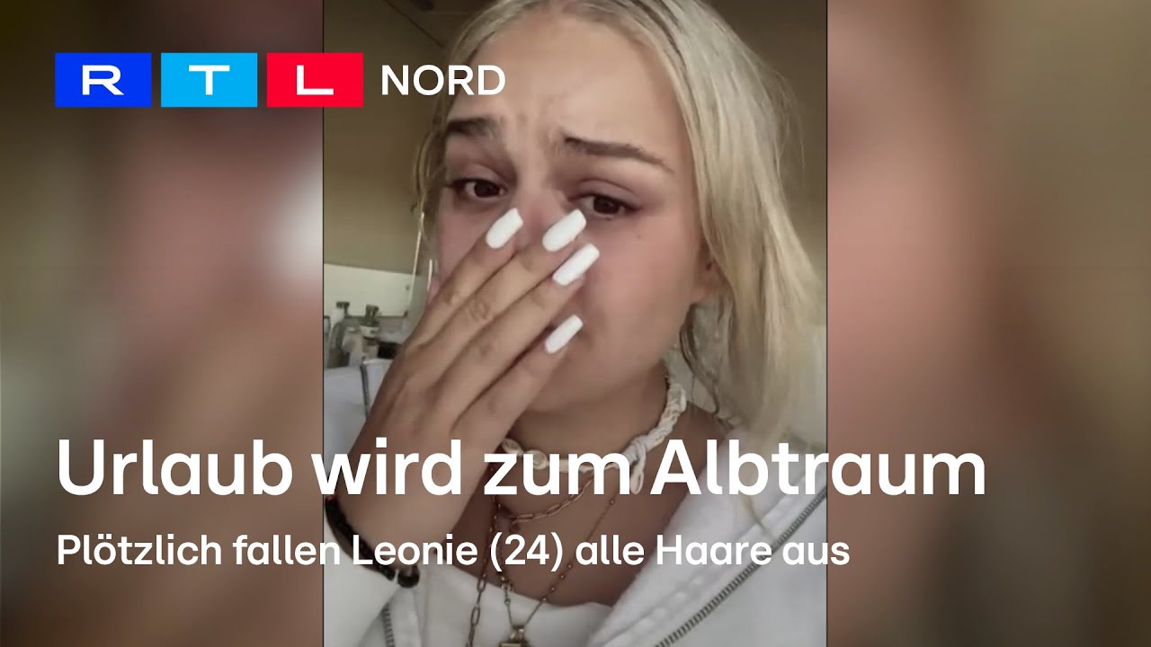 Plötzlich Haarausfall! Leonie (24) leidet an Alopecia areata
