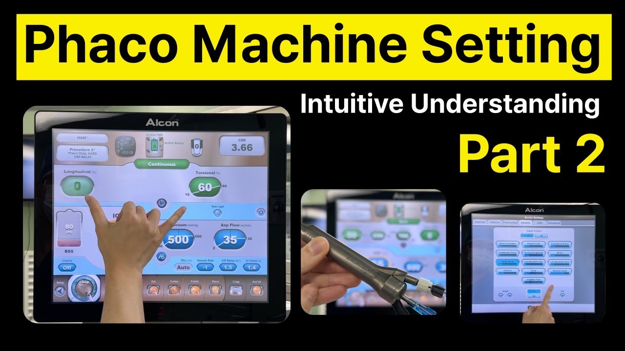 Phaco machine setting(Centurion) Part 2 as beginner