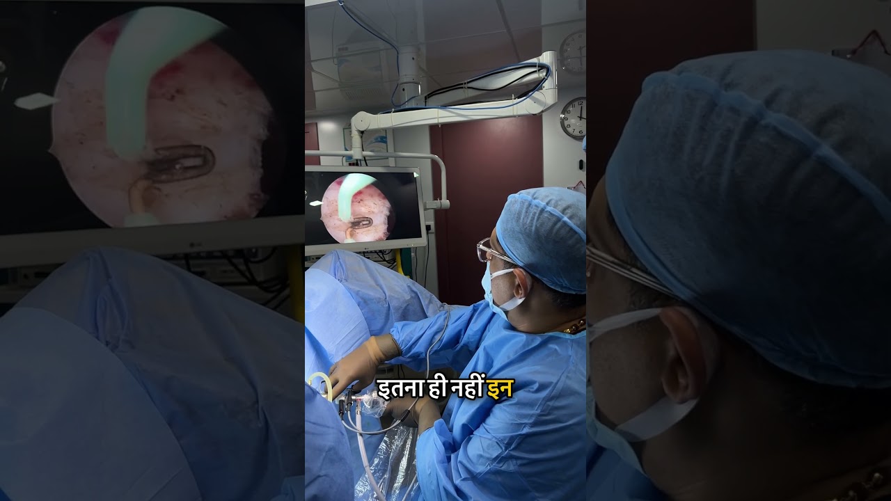 Hysteroscopy Explained!!