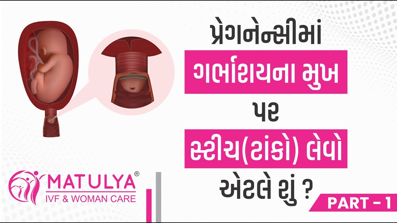 પ્રેગનેન્સીમાં ગર્ભાશયના મુખ પર સ્ટીચ(ટાંકો) લેવો એટલે શું?| Cervical stich in pregnancy|Matulya IVF