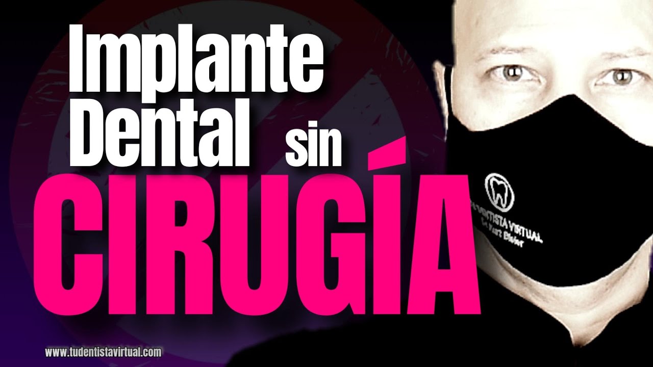 La NUEVA FORMA de REEMPLAZAR DIENTES PERDIDOS que POCOS CONOCEN!