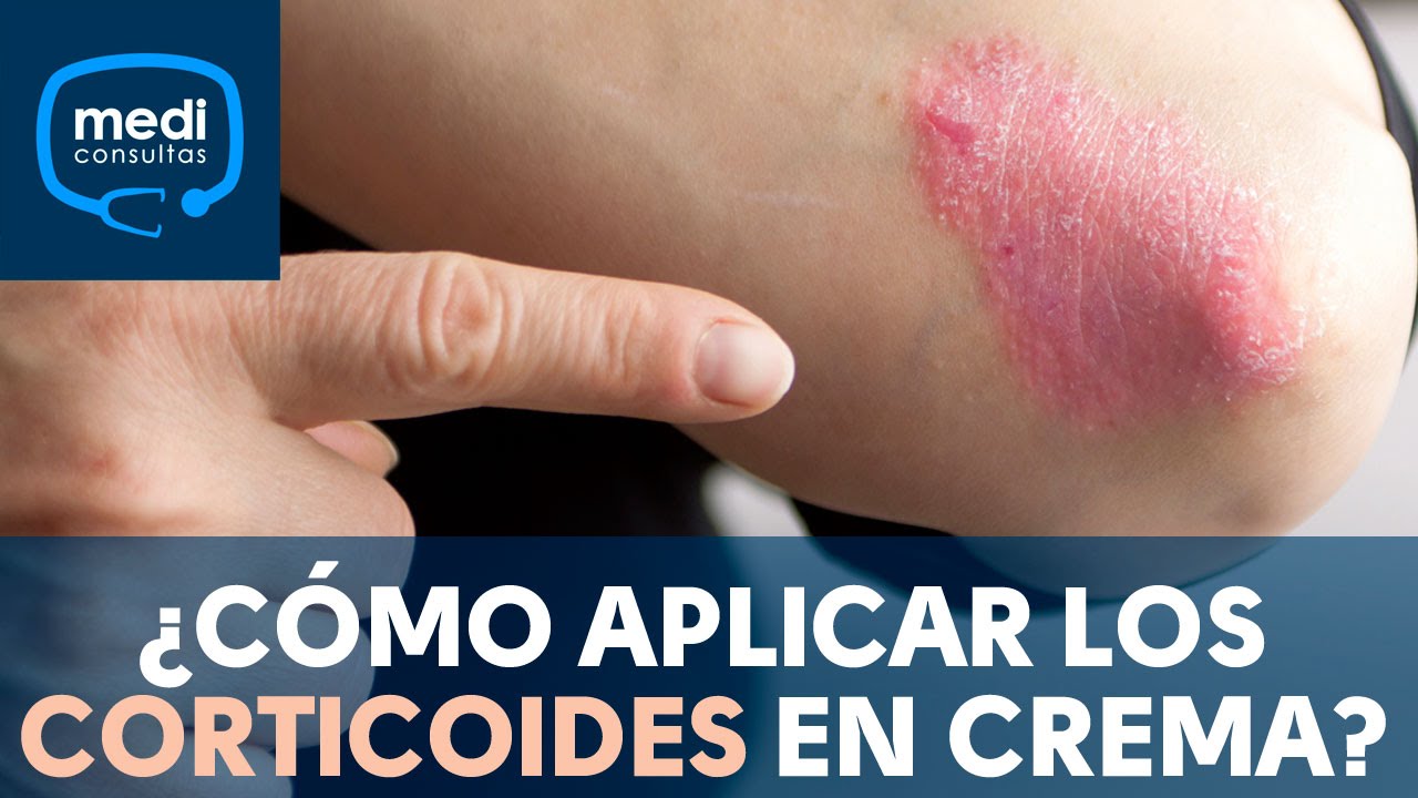 &iquest;C&oacute;mo aplicar los corticoides en crema? #MediConsultas