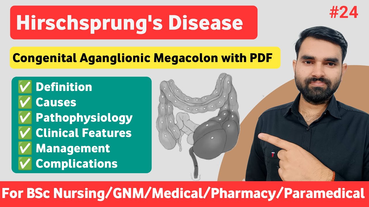 Hirschsprung's Disease in Hindi | Causes,  Clinical Features & Management of Hirschsprung's Disease