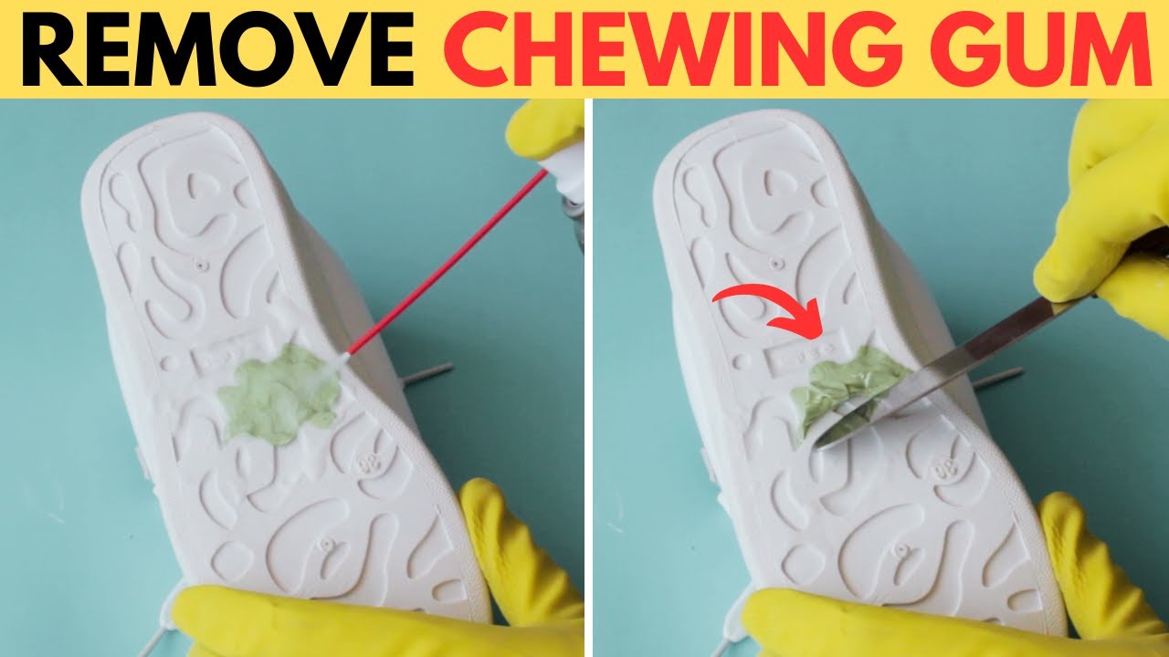 4 Best Ways to Remove Chewing Gum from Shoes