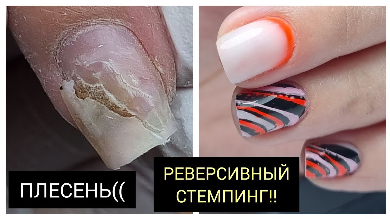 ПЛЕСЕНЬ  как быть?
