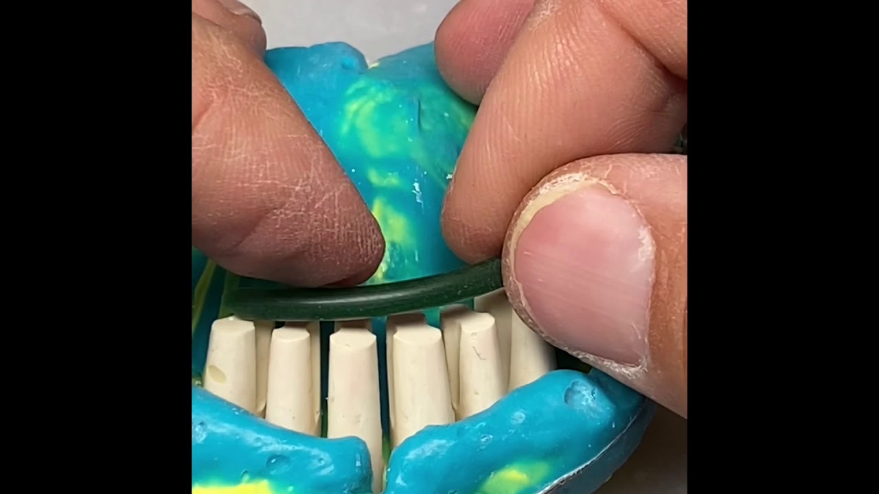 Protocol for a high precision alveolar model and refractory dies