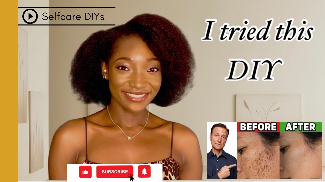 Homemade Toner for Hyperpigmentation | DIY face toner