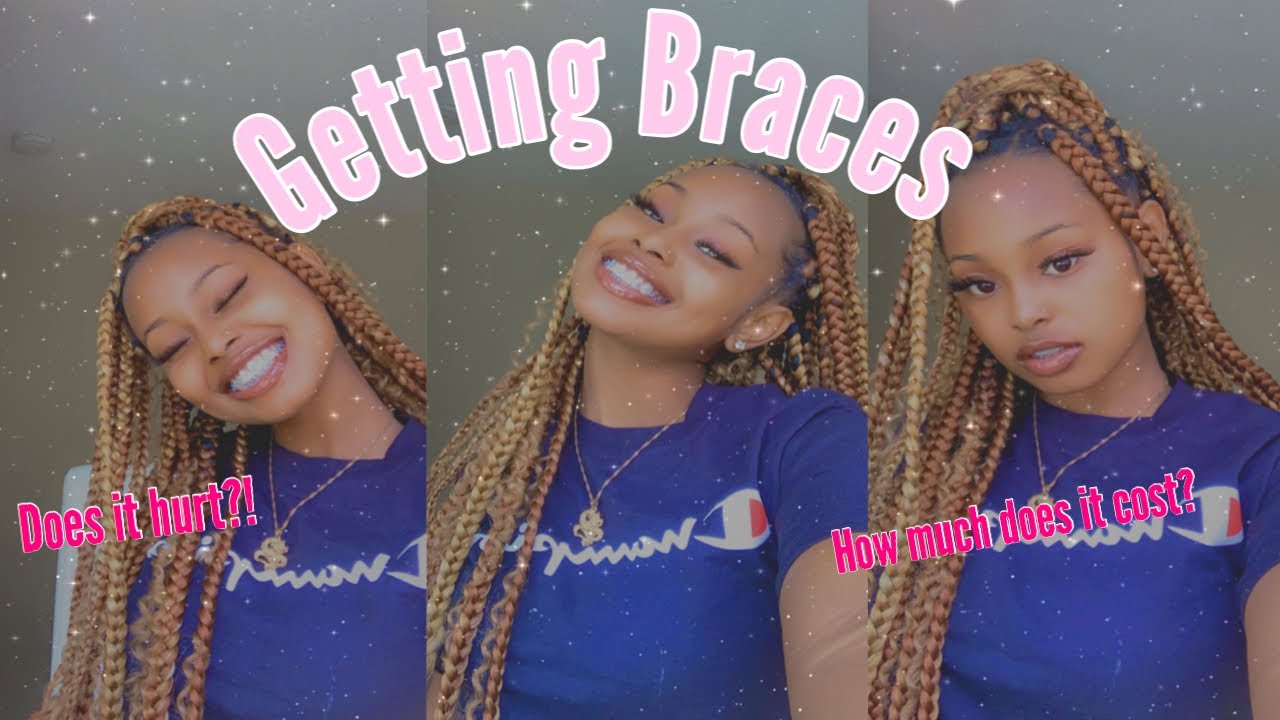 COME GET BRACES WITH ME!! (VERY DETAILED)