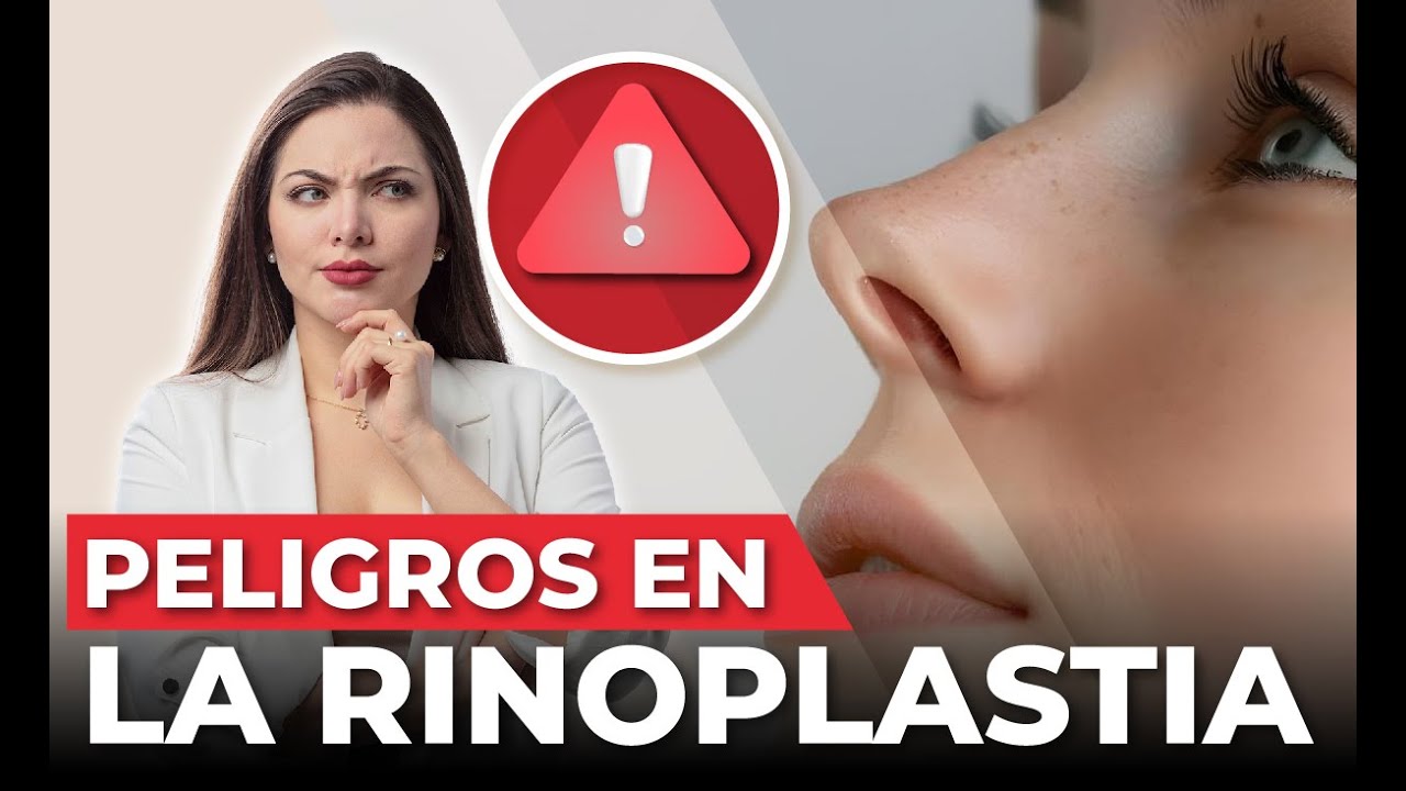 ¡No busques más en Google! | Acá te revelo TODA LA VERDAD sobre la RINOMODELACIÓN