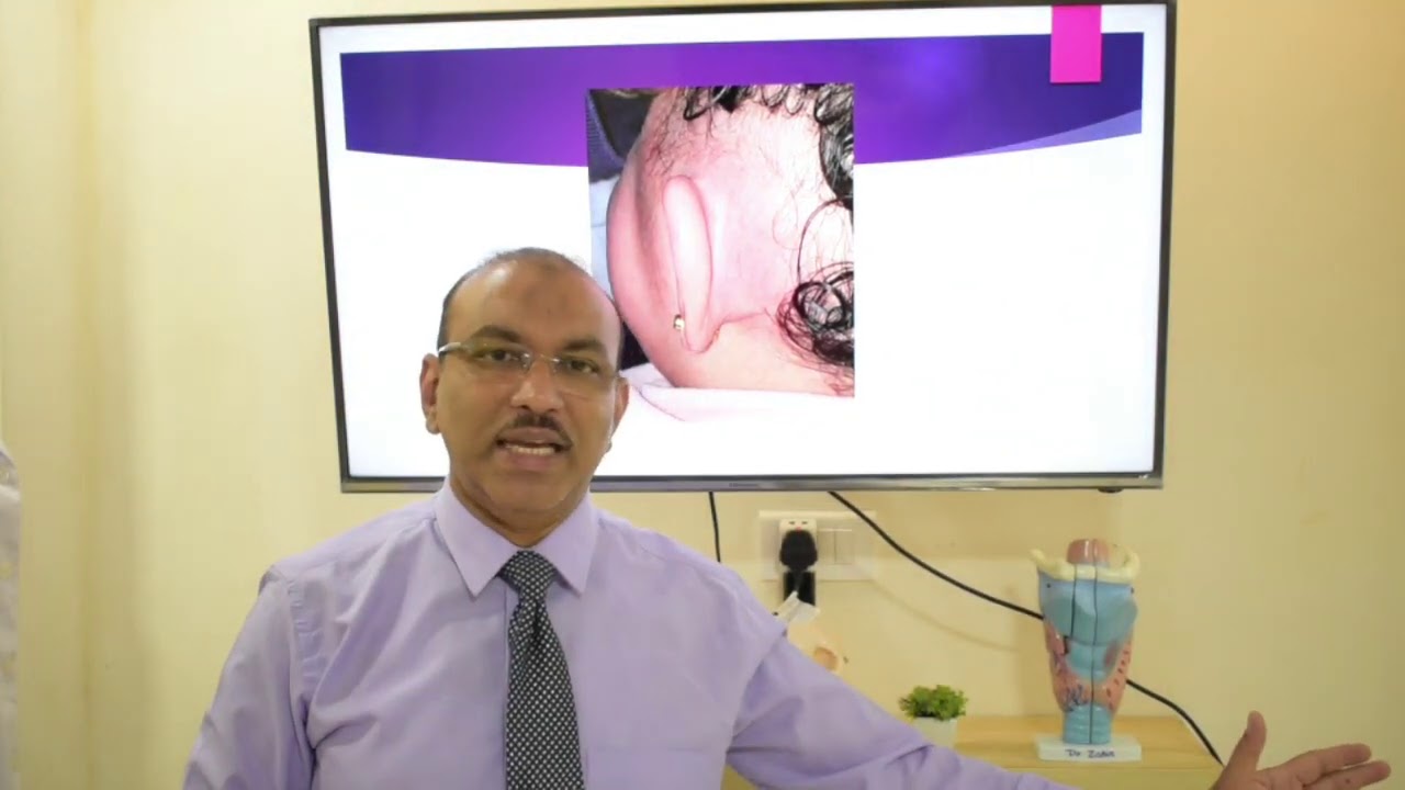 Complications of otitis media (English) Patient teaching programme