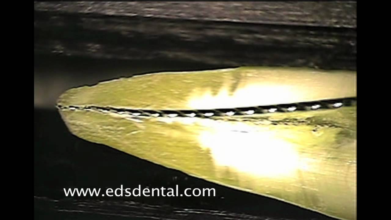 Cutting action of a endodontic file vs. reamer