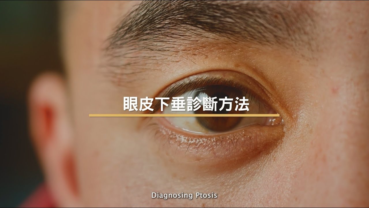 [醫生講場]  眼皮下垂的診斷及治療方法 (莊金隆醫生) Diagnosis and treatment of Ptosis (Dr Chong Kam Lung, Kelvin)
