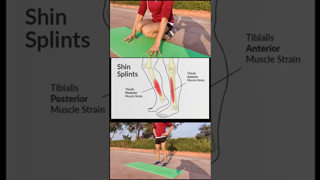 Shin Pain Relief Exercise 🔥👍|| #Shorts
