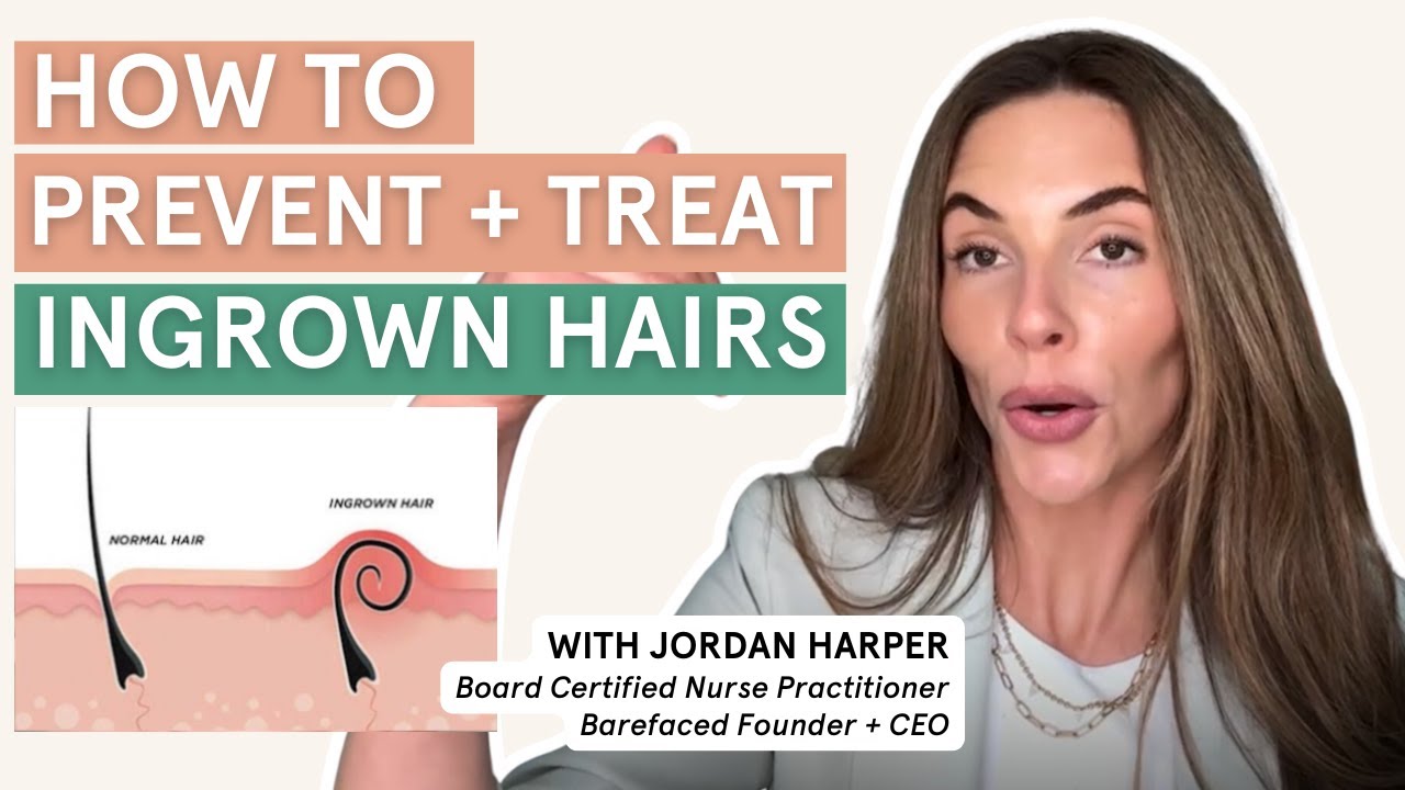 How to Prevent and Treat Ingrown Hairs