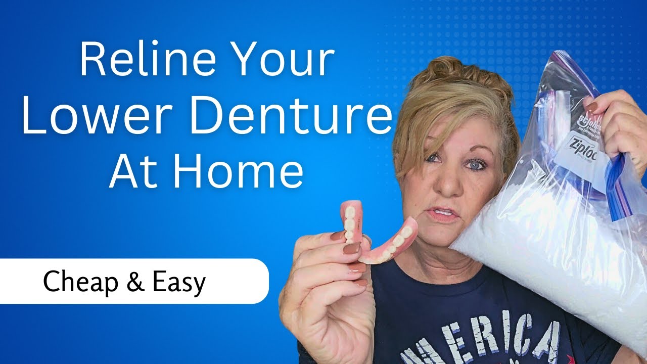 Lower Denture Reline with Thermoplastic Beads