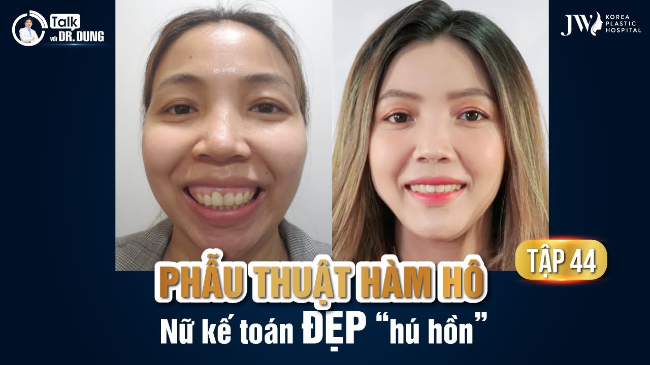 Talk Với Dr Dung (Mùa 3) | Tập 44 - PHẪU THUẬT HÀM HÔ - KẾ TOÁN LÊN ĐỜI NHAN SẮC