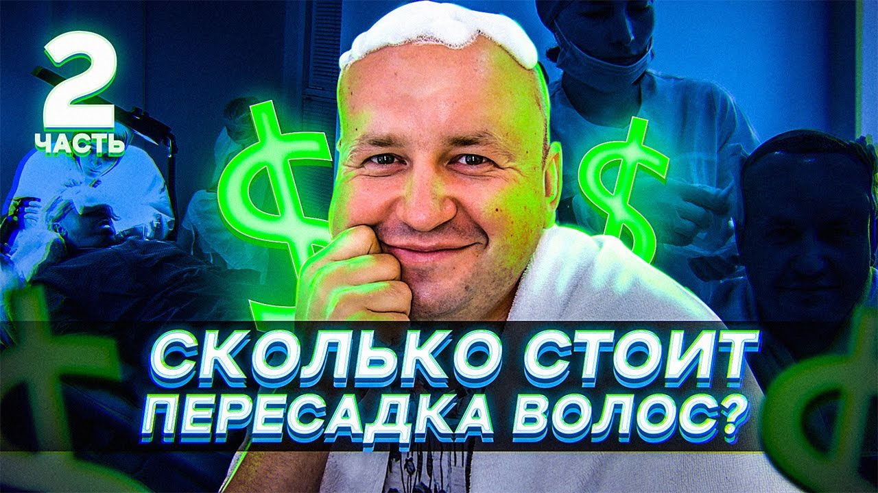 Сколько стоит пересадка волос в Махачкале | Часть 2 | Моя история трансплантации волос