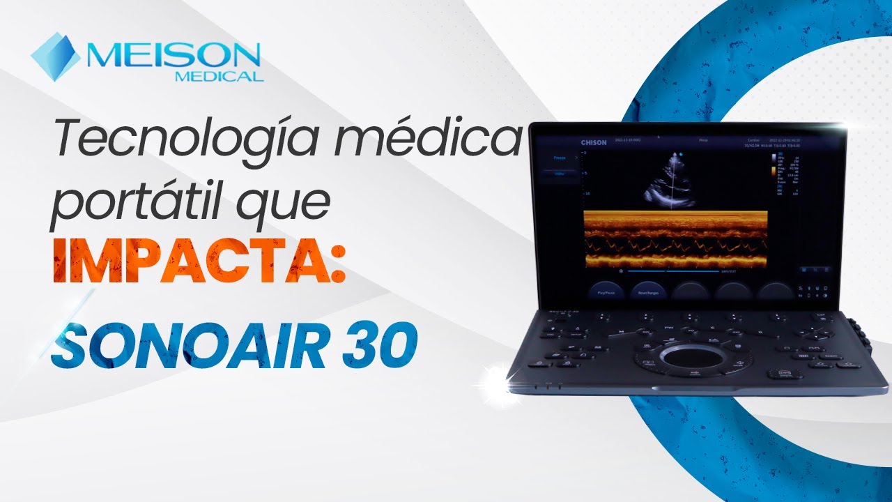 Así funciona el  SONOAIR 30 – El Futuro del ULTRASONIDO PORTÁTIL