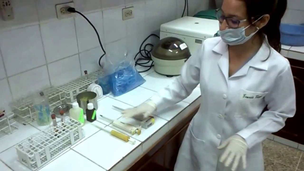 14. DETERMINACION DE AMILASA Y LIPASA