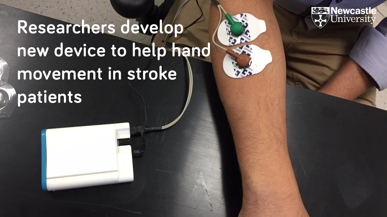 Device to help stroke patients recover hand movement