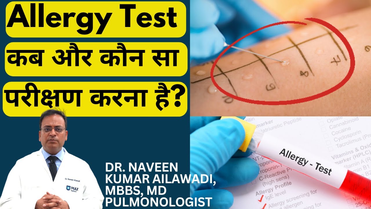 Allergy Test कब और कौन सा परीक्षण करना है? Dr. Naveen Kumar Ailawadi, MBBS, MD Pulmonologist