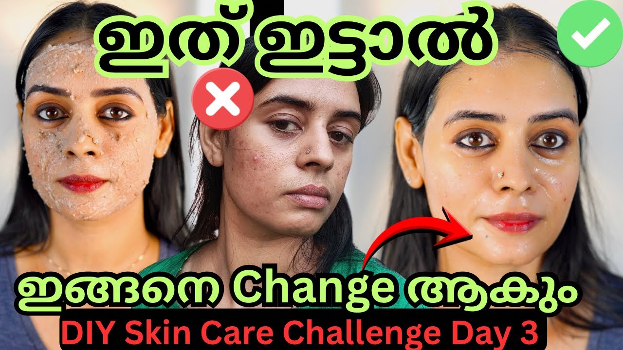 മുഖത്തെ എല്ലാം പ്രശ്നങ്ങൾക്കും ഇത് മാറ്റം തരും 😳 നുറുകണക്കിന് ആളുകൾക്ക് റിസൾട്ട്‌ തന്ന മൊതല് ആണ് 😘 