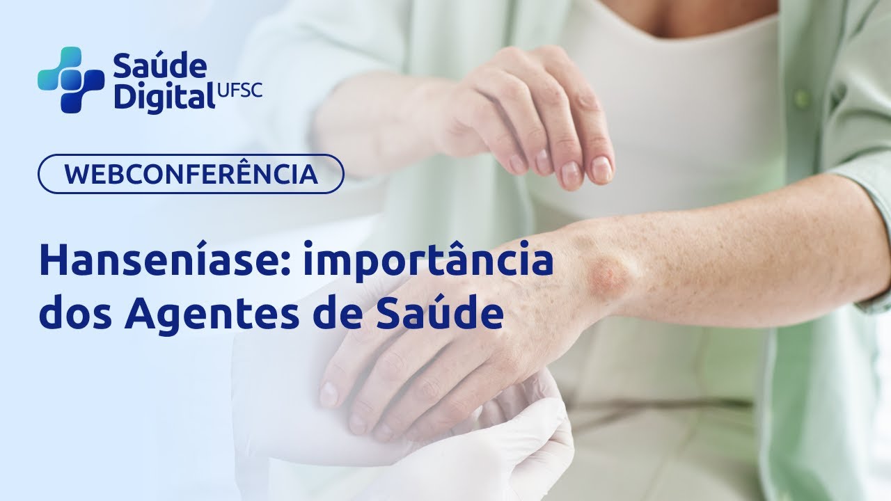 Webpalestra - Hanseníase: importância dos Agentes de Saúde