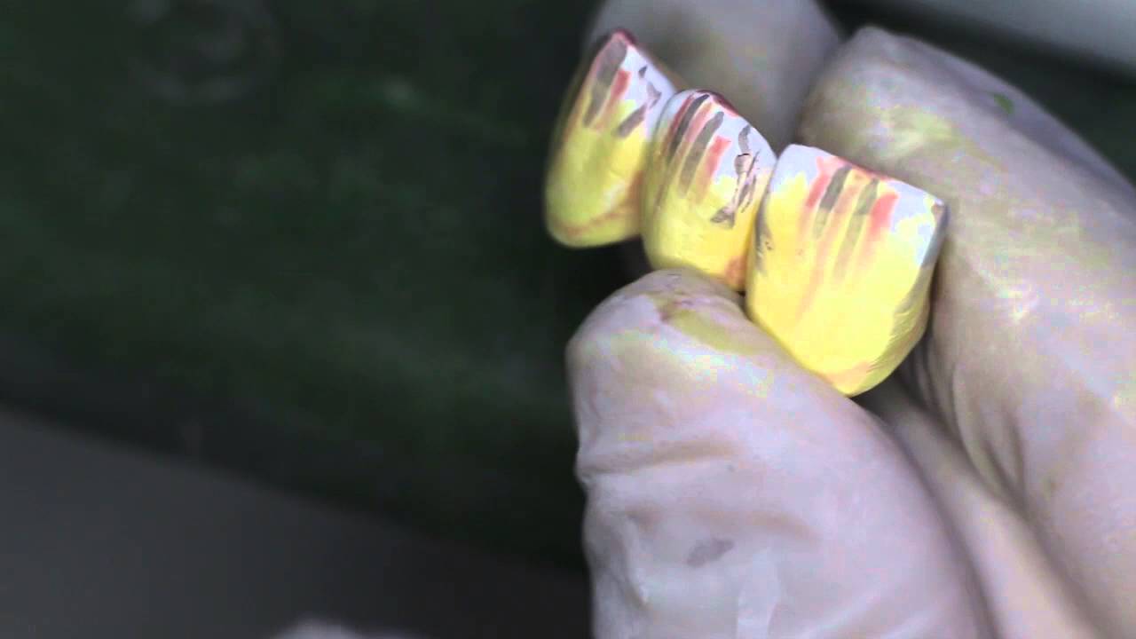 Pre-Sinterd Zirconia Coloring Advanced Technique