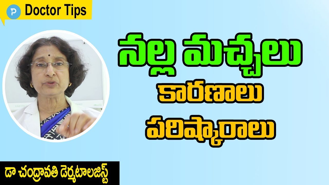 మీ ముఖం పై నల్లమచ్చలు వస్తున్నాయా: డా చంద్రావతి డెర్మటోలోజిస్ట్  | Pigmentation Treatment