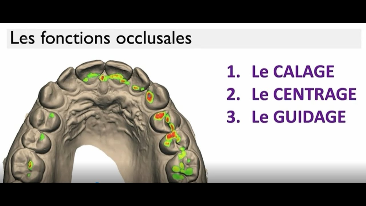 Feel FORMATION Extraits Prof  J D Orthlieb en session 2 minutes d'occlusion DEF