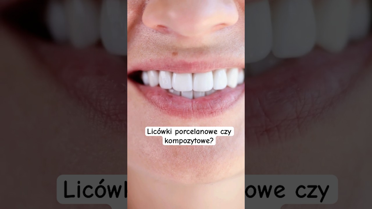 Lic&oacute;wki porcelanowe a kompozytowe &ndash; jakie są r&oacute;żnice i kt&oacute;re warto wybrać?