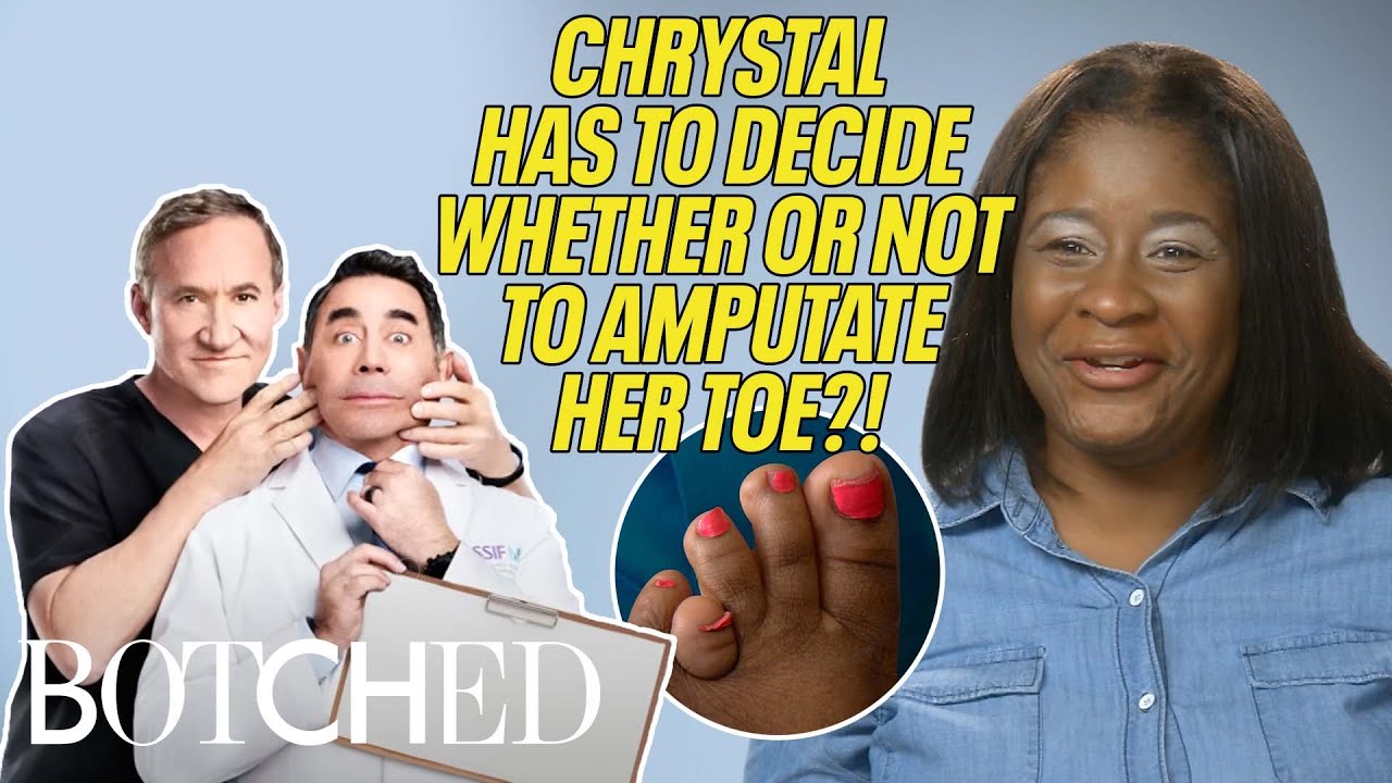 Chrystal's Toe Deformity Is Causing EXCRUCIATING PAIN (Before & After) | Botched | E!