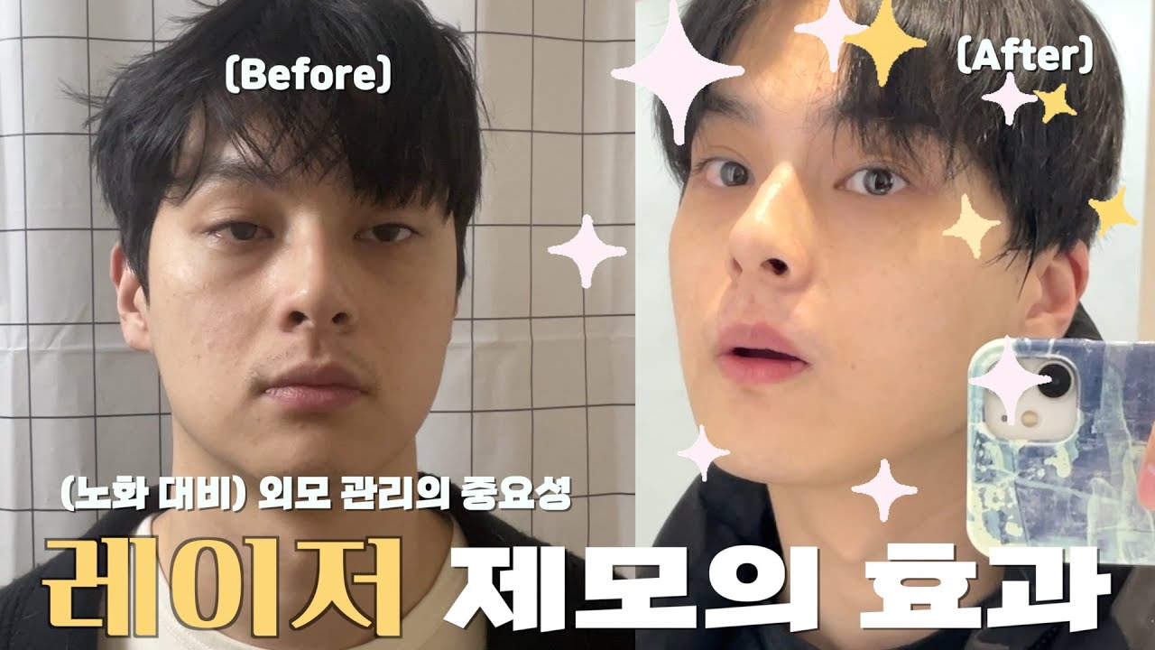 30대 남자 외모 관리 브이로그✨ | 건성 피부, 스킨 케어, 운동, 레이저 제모