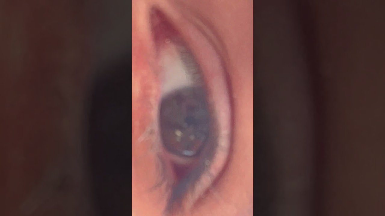 Owners eye vs pet dogs eye✨🐶👧🏻
