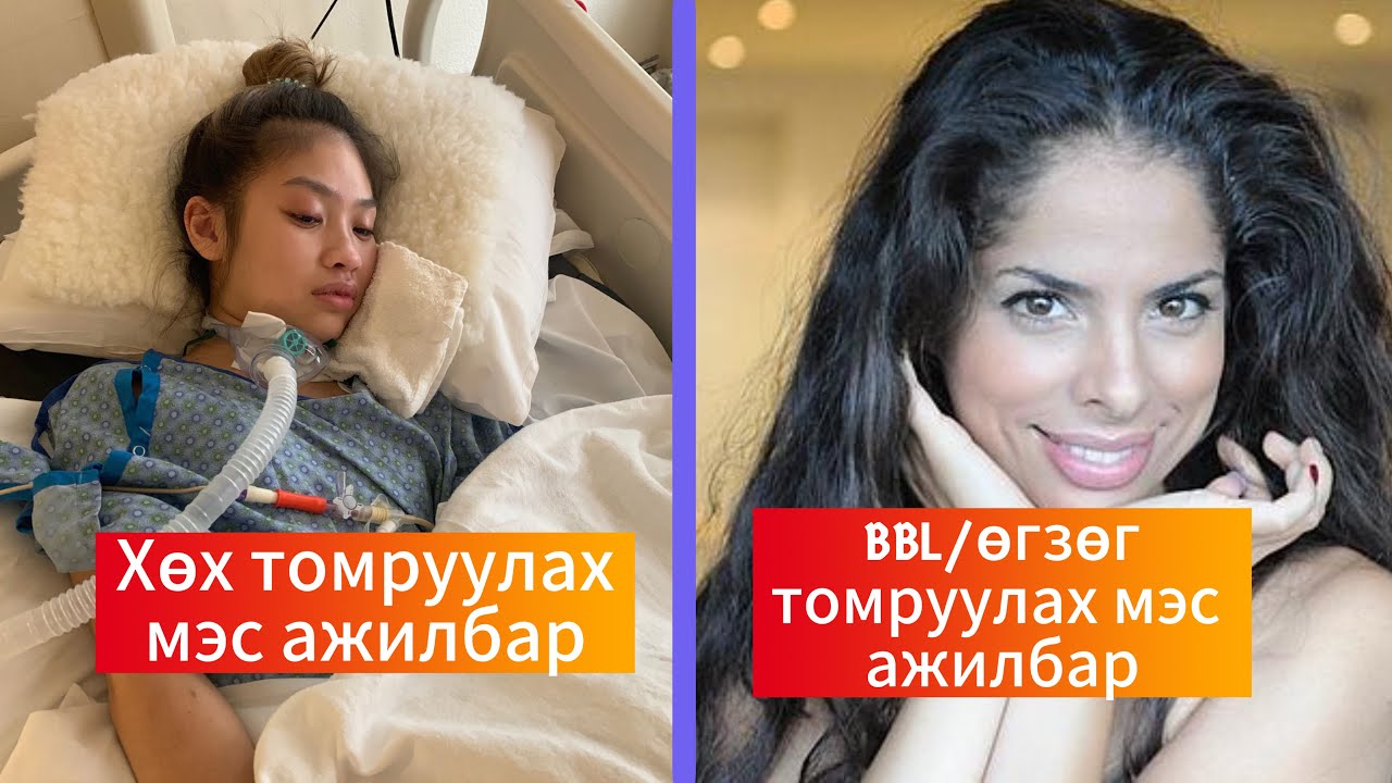Podcast #130 Бүтэлгүйтсэн гоо сайхны хагалгааны 2 түүх