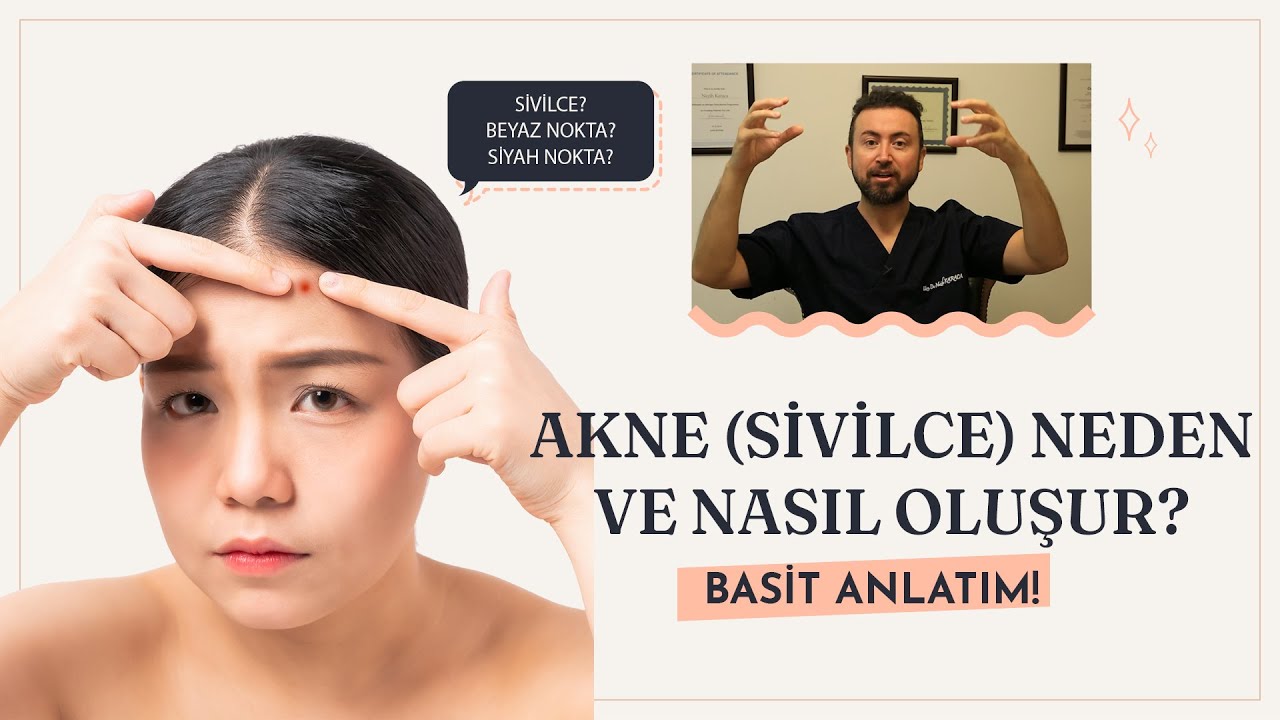 Akne (Sivilce) neden oluşur? Mekanizması Herkesin anlayabileceği şekilde sadeleştirildi.
