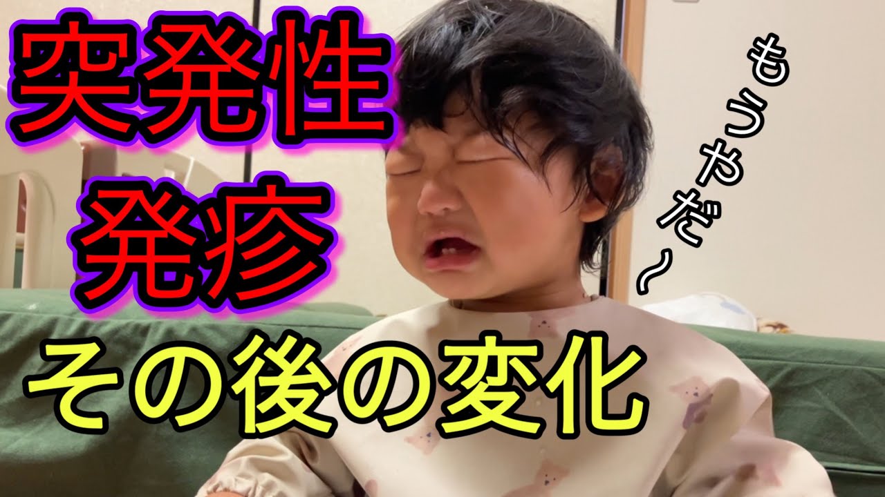 【突発性発疹】発疹が出てから、昊ちゃんに変化が！？