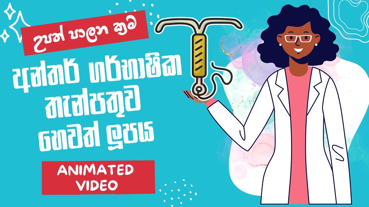 LOOP | IUCD | Contraceptive Device | IUD Sinhala video | අන්තර් ගර්භාෂික තැන්පතුව හෙවත් ලූපය