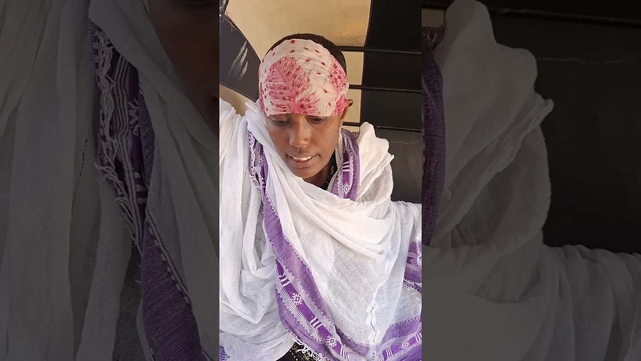 እህታችን ሁሉም ቤተሰቦቿ ሊያስታምሟት ፈቃደኛ አይደሉም😥