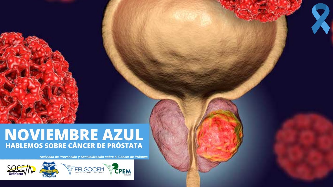 Hablemos sobre Cáncer de Próstata: Enfocado desde la Anatomía Patología